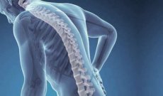 Osteoporosi: sintomi e cure