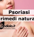 Curare la psoriasi con i rimedi naturali