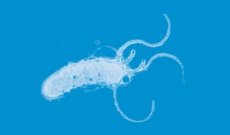 helicobacter pylori sintomi