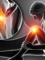 Curcumina per Articolazioni e Osteoartrite