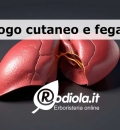 Sfogo cutaneo dovuto al fegato